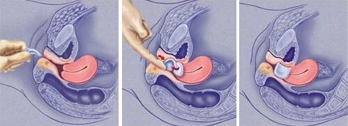 ֱŮȫ׼ọ̈̄ͼ_ȫ