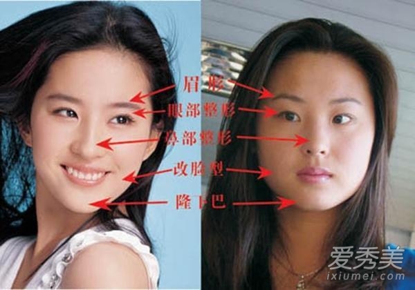 网曝刘亦菲整容 前后对比照曝光