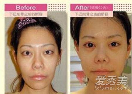 ̨�塰����Ů������˹������ǰ���ճ�þ���_˹������ǰ��Ƭ