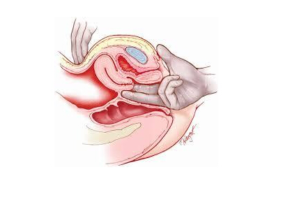 ������ʲô��״�ģ�����Ů���Ĵ�˽�����������˽����_������ʲô��״