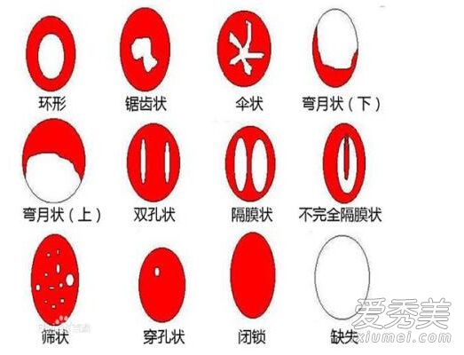 ������ʲô��״�ģ�����Ů���Ĵ�˽�����������˽����_������ʲô��״