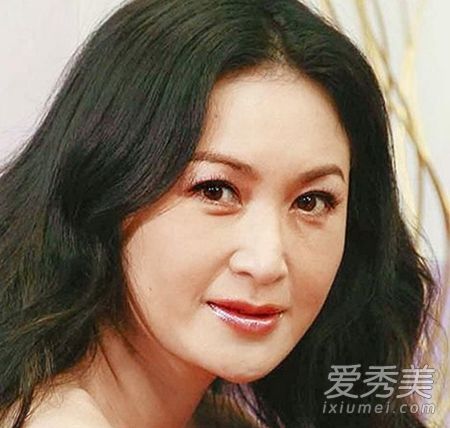 陈学冬旧照前后对比疑整容 盘点大胆承认整容的明星