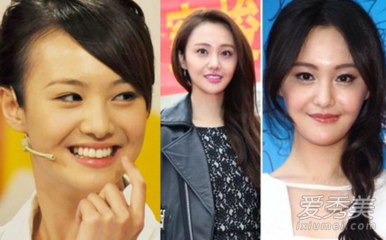 陈学冬旧照前后对比疑整容 盘点大胆承认整容的明星
