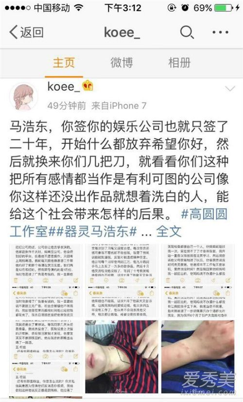 ���ƶ���Ů�Ѷ�̥�¼� ���ƶ�����������Ƭ΢��_�������ƶ�