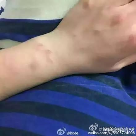 ���ƶ���Ů�Ѷ�̥�¼� ���ƶ�����������Ƭ΢��_�������ƶ�