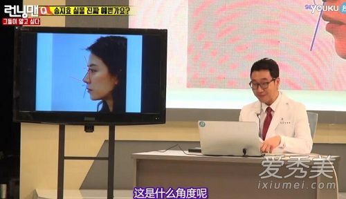 runningman宋智孝整容了吗 宋智孝整容鉴定是哪一期_宋智孝整容前后