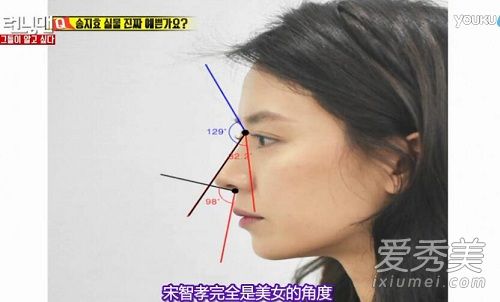 runningman宋智孝整容了吗 宋智孝整容鉴定是哪一期_宋智孝整容前后