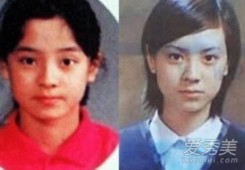 runningman宋智孝整容了吗 宋智孝整容鉴定是哪一期_宋智孝整容前后