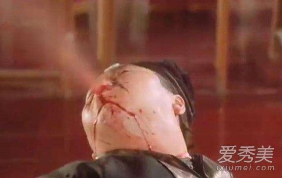 �Ѫ�ĵ��Ӿ�����Щ���й�ʮ��Ѫ���Ӿ��̵�_���Ӿ��ȫ