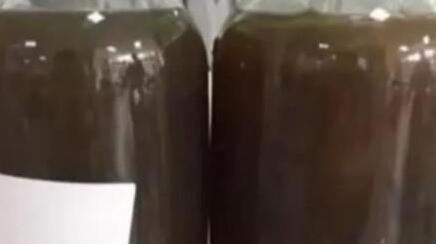 �Կ�ͳ���ƿ��Ѫ������� �Կ�ͳ���ƿ��Ѫ����ô����_��������Σ��