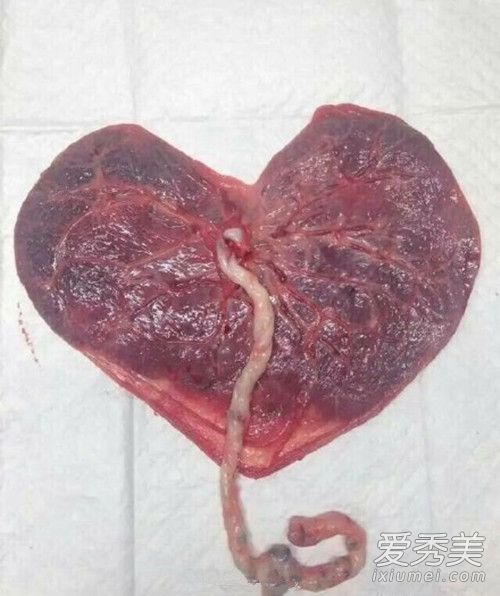 ̥����ʲô����ͼƬ ̥���ܳ��� Ӫ����ֵ���