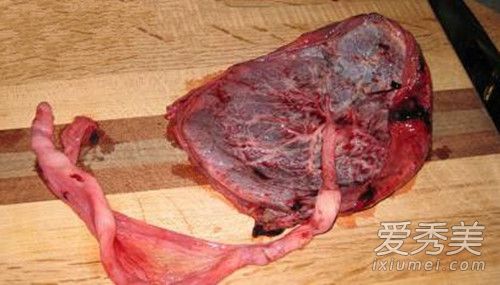 胎盘是什么样的图片 胎盘能吃吗 营养价值如何