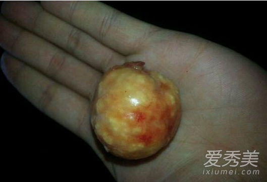 �ӱ�����ɱ���ñ� ������ʲô����ֵǮ��