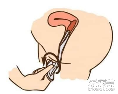 女用避孕套怎么戴 女用避孕套真人演示图解