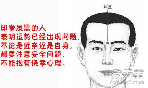 印堂是哪里 印堂发黑是什么原因 印堂要怎么看相