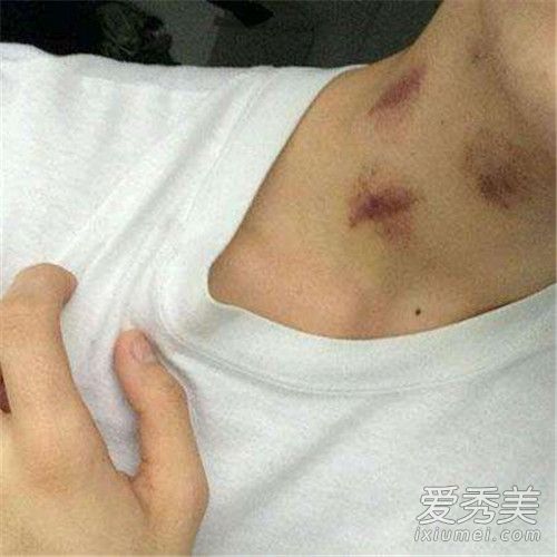 �ֲ�ݮ�Ǻ���ôŪ �ֲ�ݮ�Ǻ���ô����