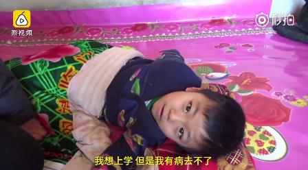 8岁男童患罕见石骨症是怎么回事 石骨症是什么意思