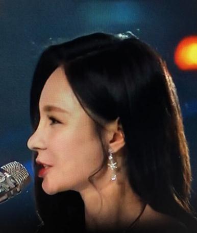 沈梦辰鼻子又整容前后对比照 沈梦辰鼻子好奇怪