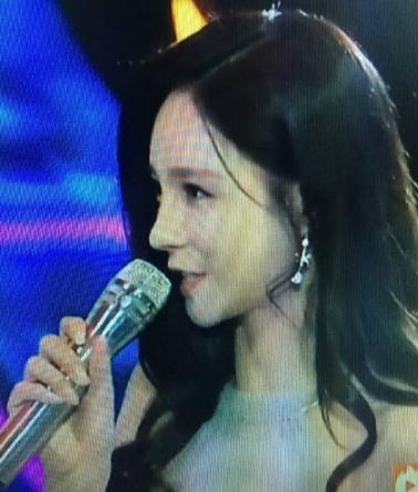 沈梦辰鼻子又整容前后对比照 沈梦辰鼻子好奇怪