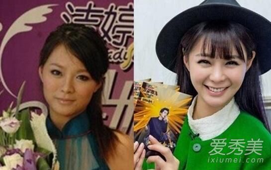 沈梦辰鼻子又整容前后对比照 沈梦辰鼻子好奇怪