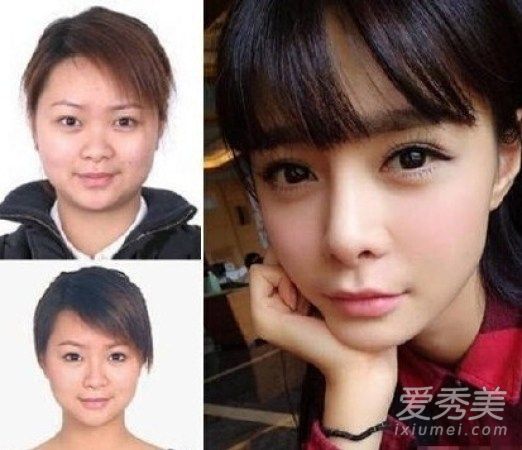 沈梦辰鼻子又整容前后对比照 沈梦辰鼻子好奇怪