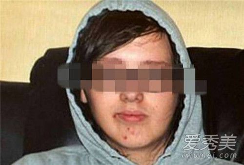 ���껼����������ô���� ���ػ�����ʲô֢״