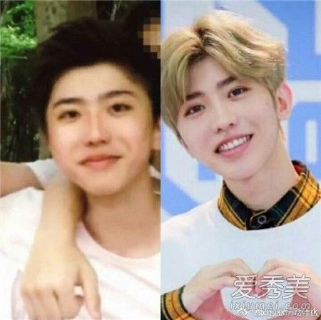 蔡徐坤整容前后照片对比 到底是整牙还是换脸了?
