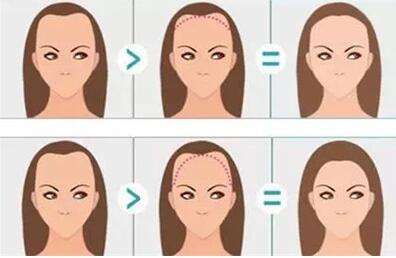 ���ݺ��ϰ�Ѫ֢��ô���� ���ݻ��к���֢��