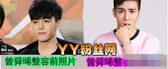 曾舜晞整容前后照片对比 曾舜晞整容前旧照