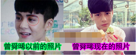 曾舜晞整容前后照片对比 曾舜晞整容前旧照