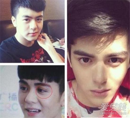 曾舜晞整容前后照片对比 曾舜晞整容前旧照