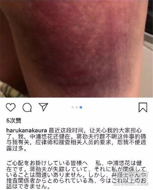 ���������ٲ���������� ���������ٲ�����ʲôԭ��