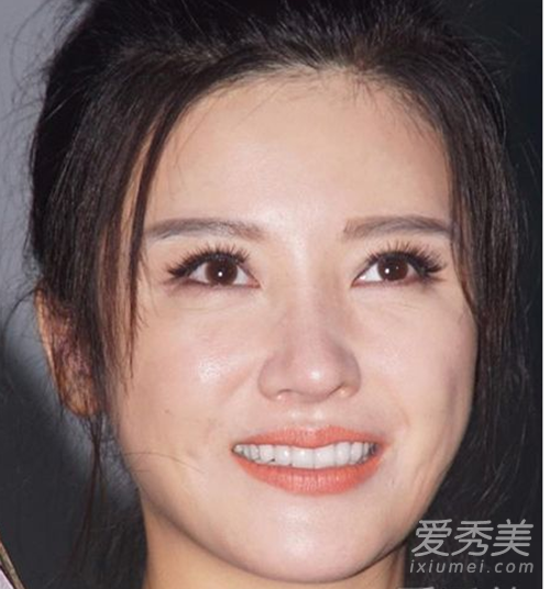 ���������ǰ��Ա�ͼ ǰ�����޴�����ɵɵ�ֲ������