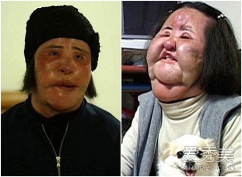 电风扇阿姨去世享年57岁 整容前后照片对比令人唏嘘!