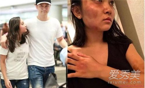 ������ͽ�ʧ������ô���� ������ͽ�ʧ��ԭ��