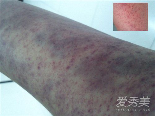 ������ʲôԭ�� ������ʲô�ô�