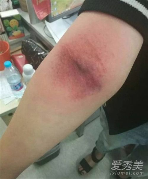 �����������ʲôΣ�� �������ɫ����ʲô