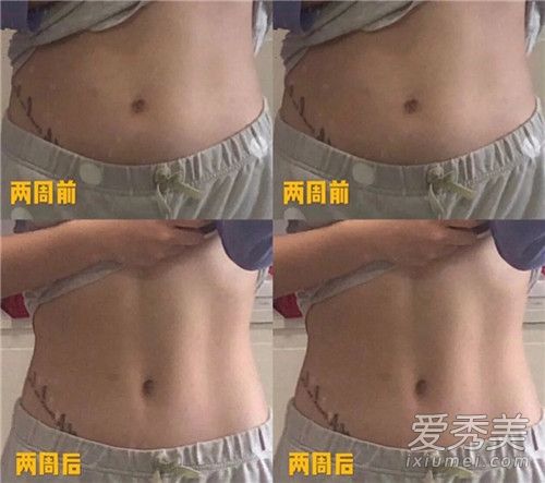 ��С������췽���˶�ͼ��