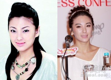 因整容失败而惨不忍睹的十大女星