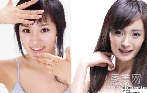 因整容失败而惨不忍睹的十大女星