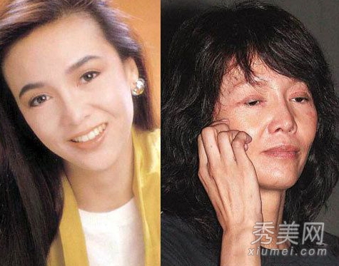 因整容失败而惨不忍睹的十大女星