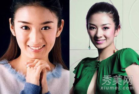 因整容失败而惨不忍睹的十大女星