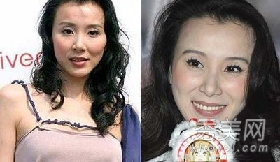 因整容失败而惨不忍睹的十大女星