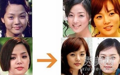 因整容失败而惨不忍睹的十大女星