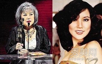 因整容失败而惨不忍睹的十大女星
