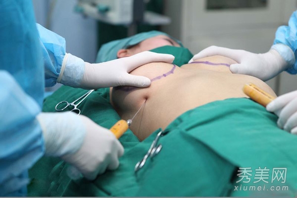 ��ģ�赤¡�ع����ع� ��������Χ����