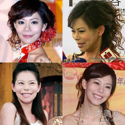 巩新亮整容失败眼珠都快掉了 女星整容失败案例