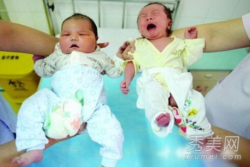 200斤高龄产妇产巨婴 国内巨大婴儿盘点