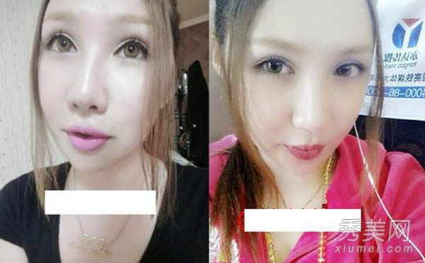 黄海波嫖娼变性女 娱乐圈“人妖”整容前后