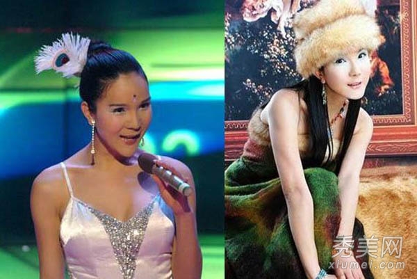 黄海波嫖娼变性女 娱乐圈“人妖”整容前后